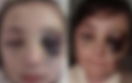 Döyüldüyü iddia edilən şagirdlə bağlı TƏFƏRRÜATLAR