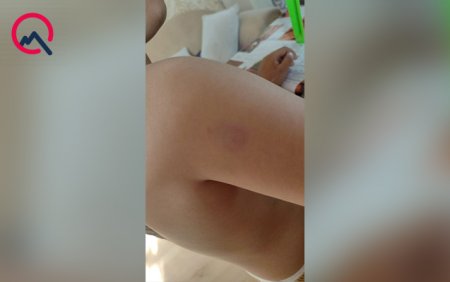 Xüsusi məktəbdə müəllim azyaşlıya şiddət göstərib? - Rəsmi açıqlama - Foto